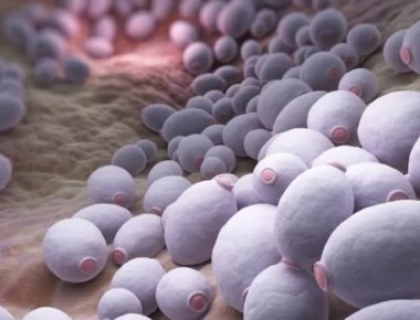 Καντιντίαση: Πώς προκαλείται, με ποια συμπτώματα εκδηλώνεται και τι πρέπει να κάνετε